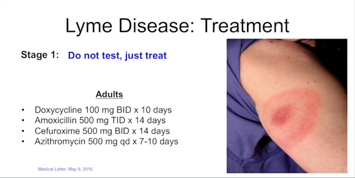 Screen Shot 2018-10-02 at 8.44.26 AM.png